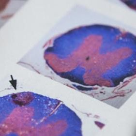 Beat Cancer Scan