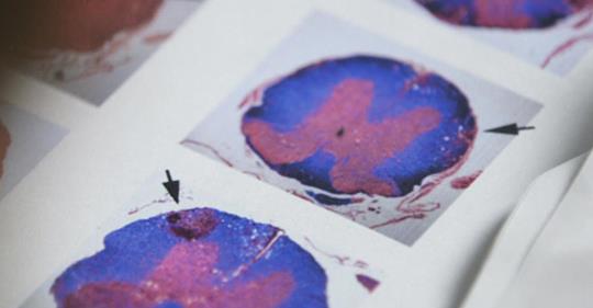 Beat Cancer Scan